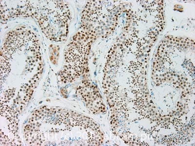 Anti-HSF1 antibody [10H8](AB61382)