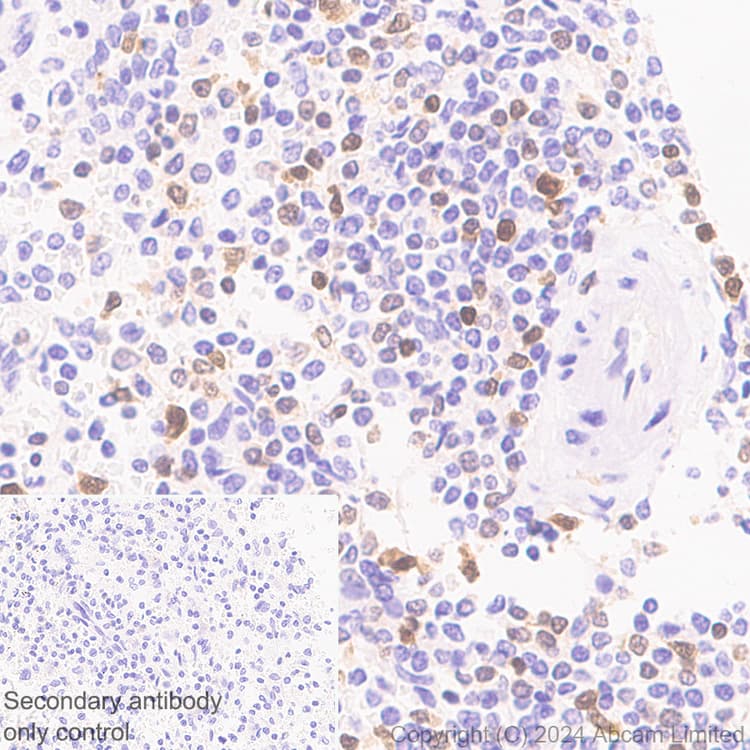 Anti-TOX antibody [EPR28108-10](ab322259)