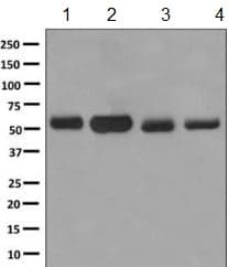 Anti-HERPUD1 antibody [EPR9649](AB150424)