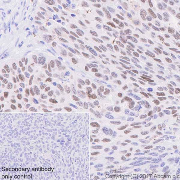 Anti-p53 (phospho S392) antibody [EP155Y] - BSA and Azide free(ab239211)