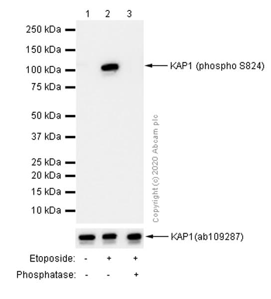 Kap1 Phospho S824 Antibody Epr5248 Bsa And Azide Free Ab215549  Western Blot Img174693