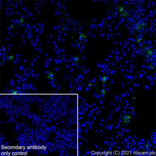 Anti-MMP9 antibody [RM1020](AB283575)
