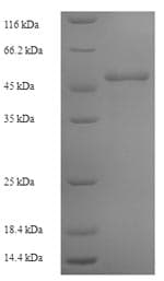 Ab235822  Sds Page Img161345