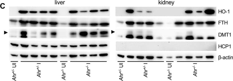 Anti-Ferritin Heavy Chain antibody [EPR18878](AB183781)