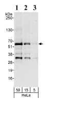 Maz Antibody Ab85725  Western Blot Img11649