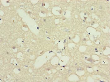 G5pr Antibody Ab230347  Immunohistochemistry Formalin Pfa Fixed Paraffin Embedded Sections Img12672