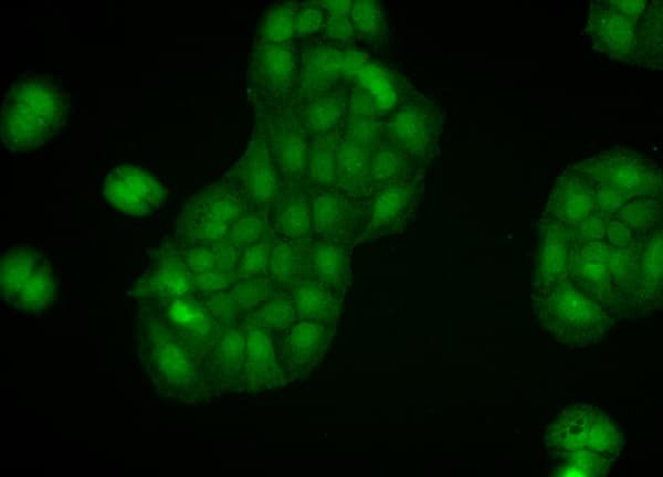 Anti-Calnexin - ER membrane marker antibody - ER Marker(AB13504)