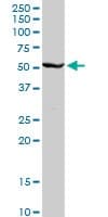 Cyp2c8 Antibody Ab103547  Western Blot Img153007