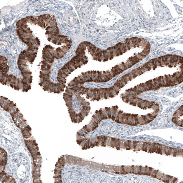 Anti-COL12A1 antibody(AB121304)