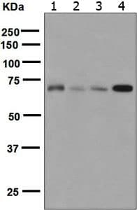 Tls Fus Antibody Epr5812 Ab124923  Western Blot Img126674