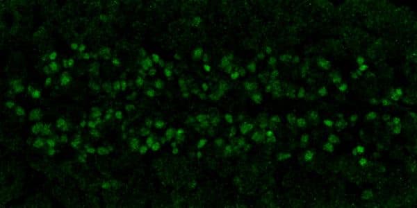 Homeobox Protein Prospero Antibody P3d4 1f10 Ab201326  Immunocytochemistry Immunofluorescence Img70026