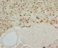 Anti-MIST-1 antibody [6E8/A12/C11P1] - C-terminal(AB110919)