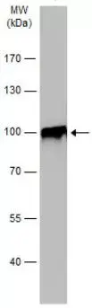 Anti-Villin antibody(AB97512)