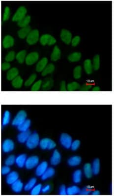 Anti-SOX2 antibody(AB137385)