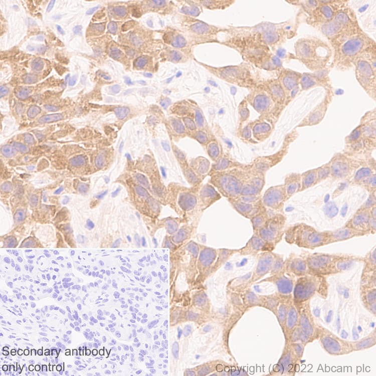Anti-PAK1 antibody [EPR26067-45](AB302506)