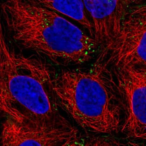 Iqgap2 Antibody Ab204225  Immunocytochemistry Immunofluorescence Img105095