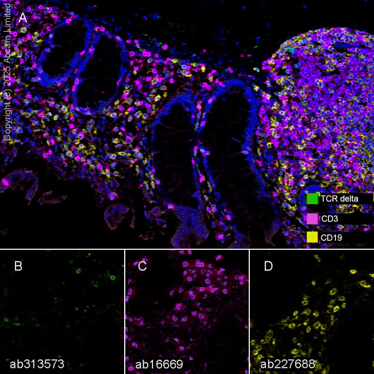 Anti-CD3 epsilon antibody [SP7] - BSA and Azide free(AB205228)
