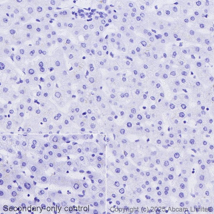 Avidin/Biotin Blocking Kit(ab64212)