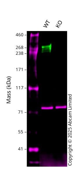 Anti-Fibronectin antibody [F14](AB45688)