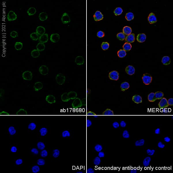 Iba1 Antibody Epr61362 Microglia Marker Ab178680  Immunocytochemistry Immunofluorescence Img169075