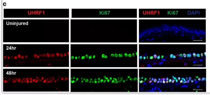 Anti-Ki67 antibody(AB15580)