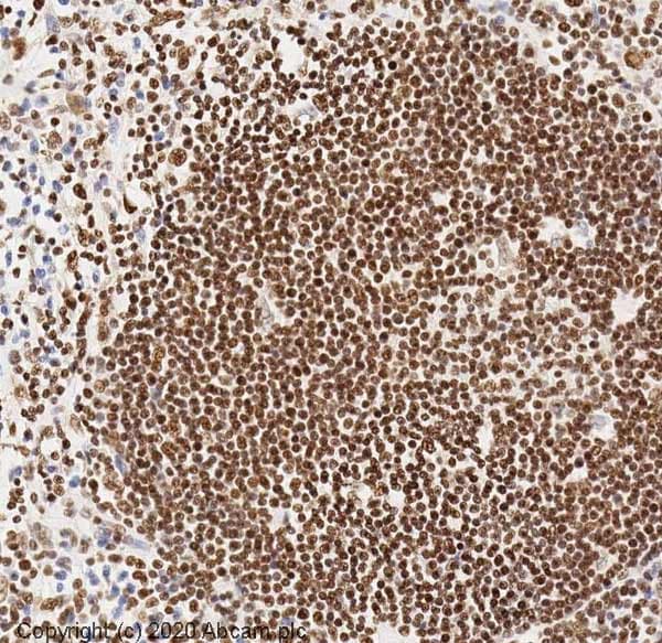 Anti-RNA polymerase II CTD repeat YSPTSPS antibody - ChIP Grade(AB26721)