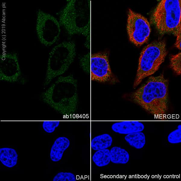 Anti-FRAT1 antibody [EPR3900](AB108405)