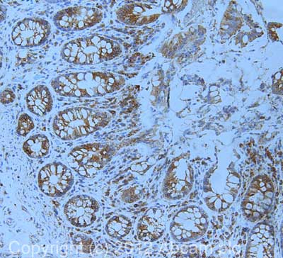 Anti-Calnexin antibody [6F12BE10](AB112995)