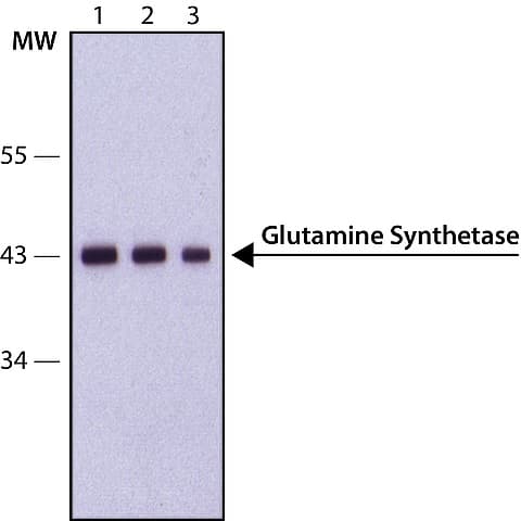 Anti-Glutamine Synthetase antibody(AB49873)