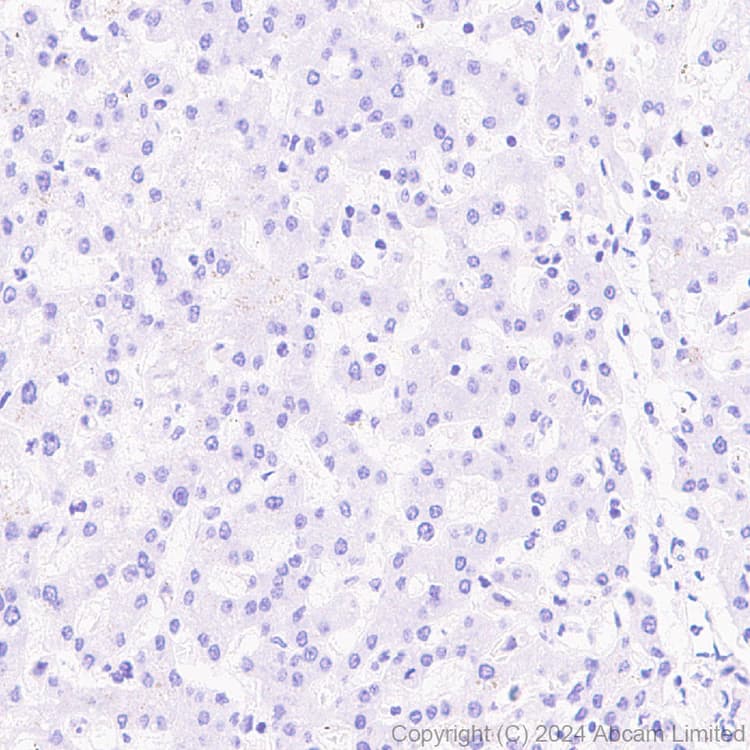 Anti-Prosurfactant Protein C antibody [RM1264](AB322443)