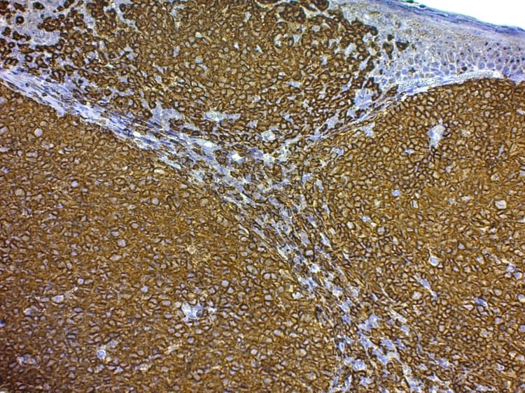 Mounting Medium for IHC - Aqueous(ab64230)