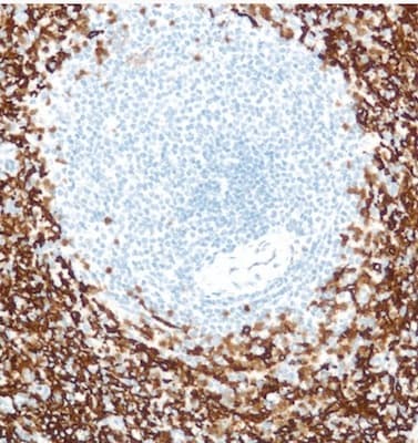 Neutrophil Marker (CD11b, CD16, CD32, CD44, CD55) Antibody Panel - Human(AB254016)