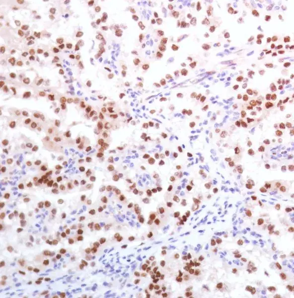 Anti-PAX8 antibody [SP348] - N-terminal(AB227707)