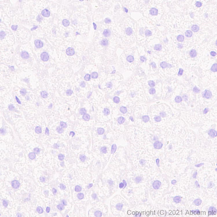Anti-KCC2 antibody [EPR24203-85](AB259969)