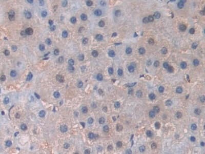 Anti-PI3 Kinase p110 beta antibody(ab232997)