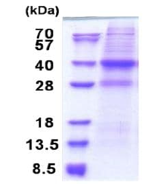 Recombinant Human CAPZA2 protein (denatured)(AB171494)