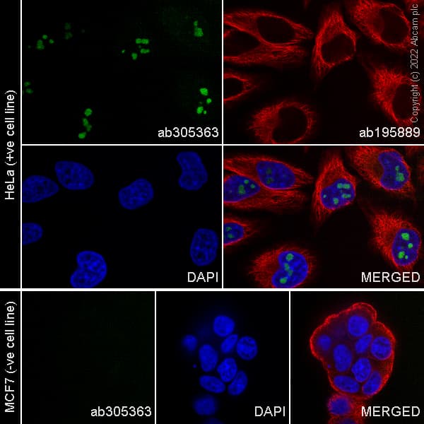Alexa Fluor® 488 Anti-CDKN2A/p14ARF antibody [SP271](AB305363)
