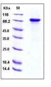 Recombinant Human HRG protein (His tag)(AB276324)