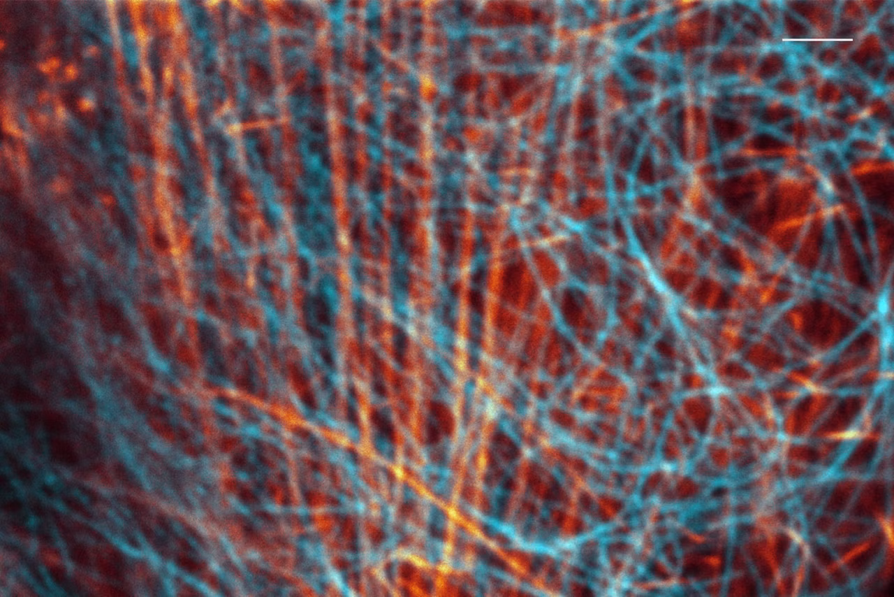 Mammaoan Cells CF440 Confocal Kid21767590