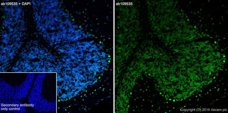 Anti-TDP43 antibody [EPR5810](AB109535)
