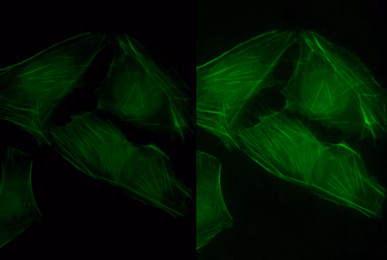 Cells Stained With Actin Im Kid21756231