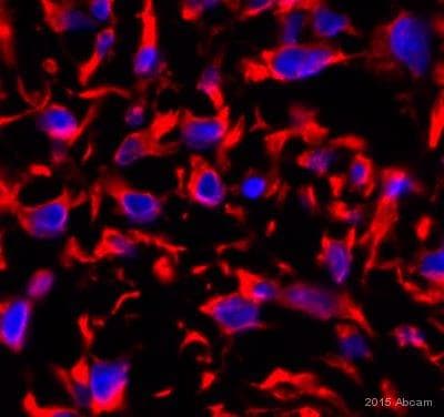 Anti-Vimentin antibody [RV202] - Cytoskeleton Marker(ab8978)