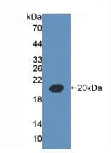 Anti-AMACR antibody(AB231333)