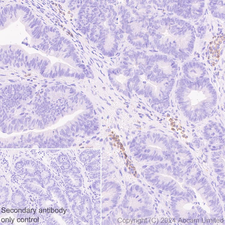 Ykl 40 Chi3l1 Antibody Rm1204 Bsa And Azide Free Ab319165  Immunohistochemistry Formalin Pfa Fixed Paraffin Embedded Sections Img434081
