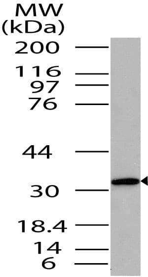 Anti-ST2 antibody(AB208283)