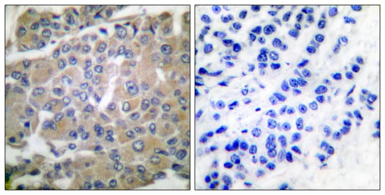 Mmp8 Antibody Ab53017  Immunohistochemistry Formalin Pfa Fixed Paraffin Embedded Sections Img170951