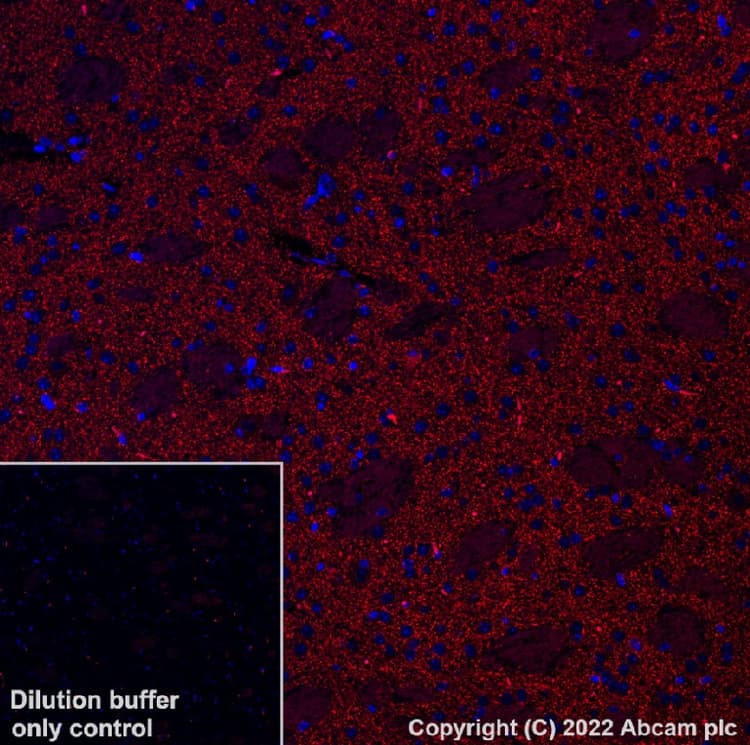 Alexa Fluor 568 Dopamine Transporter Antibody Epr19695 Ab303466  Immunohistochemistry Formalin Pfa Fixed Paraffin Embedded Sections Img402079