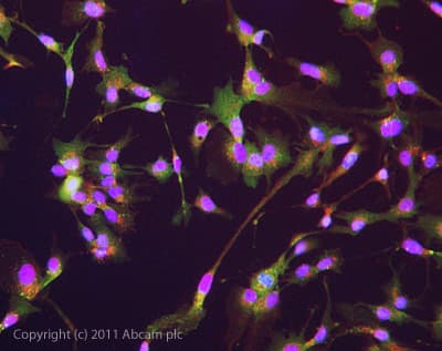 Anti-Interferon beta antibody(AB85803)