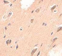 Anti-ADAMTS4 antibody(AB84792)