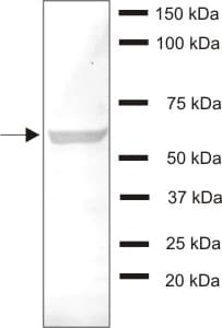 Hsp70 Antibody N27f3 4 Ab47454  Western Blot Img140458